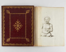 Load image into Gallery viewer, CAMPEN, Michael Johan van. Puellae monstrosae delineatio, quam annuente summo numine …